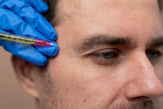 Platelet Rich Plasma (PRP)
