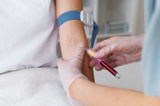 Platelet Rich Fibrin (PRF)