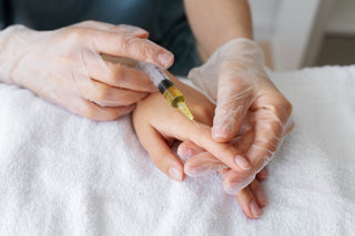 Platelet Rich Fibrin (PRF)