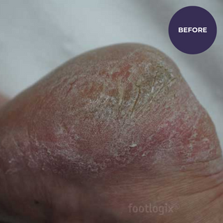 Footlogix DD Cream Mousse Formula (125ml)