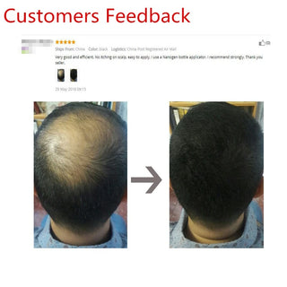 Sevich Beauty Salon Instant Thickening Hair Fiber Powder 100g Thickening Hair Building Fibers Wig Extensions Refill Black Colors