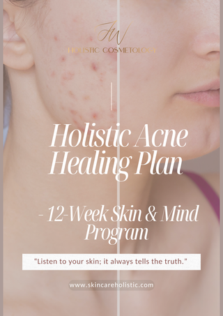 Holistic Acne Healing Plan – 12-Week Skin & Mind Program