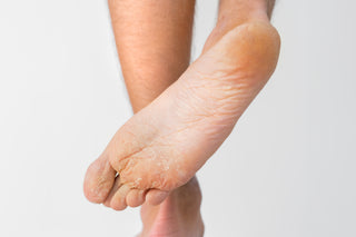 Close-up of a child's foot with a white background